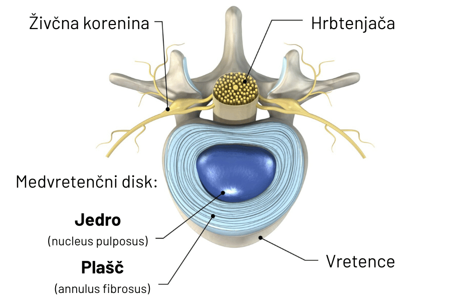 Anatomski prikaz vretenca in medvretenčnega diska v prečnem prerezu, prikazane so živčne strukture, jedro in plašč vretenca.  
