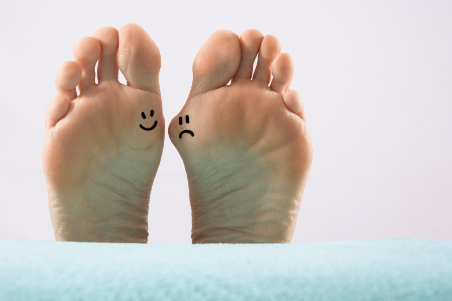 Težave s stopali - hallux valgus
