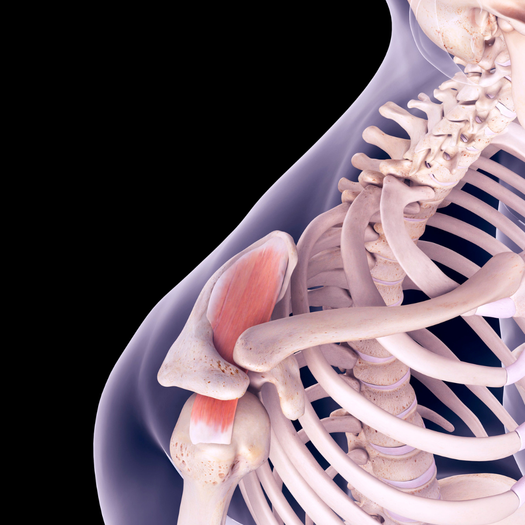 Poškodbe mišice supraspinatus