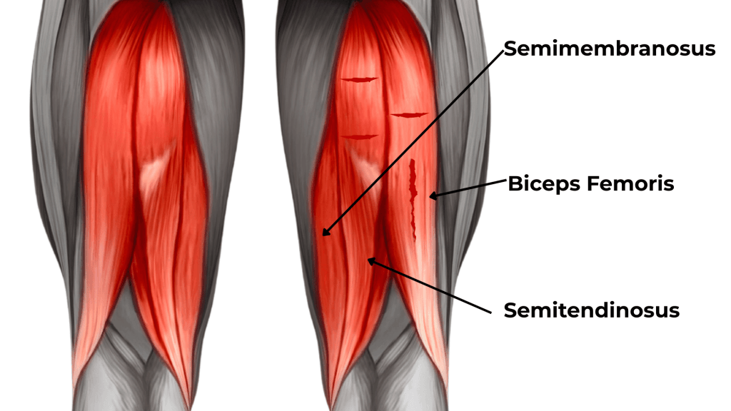Mišice zadnje lože