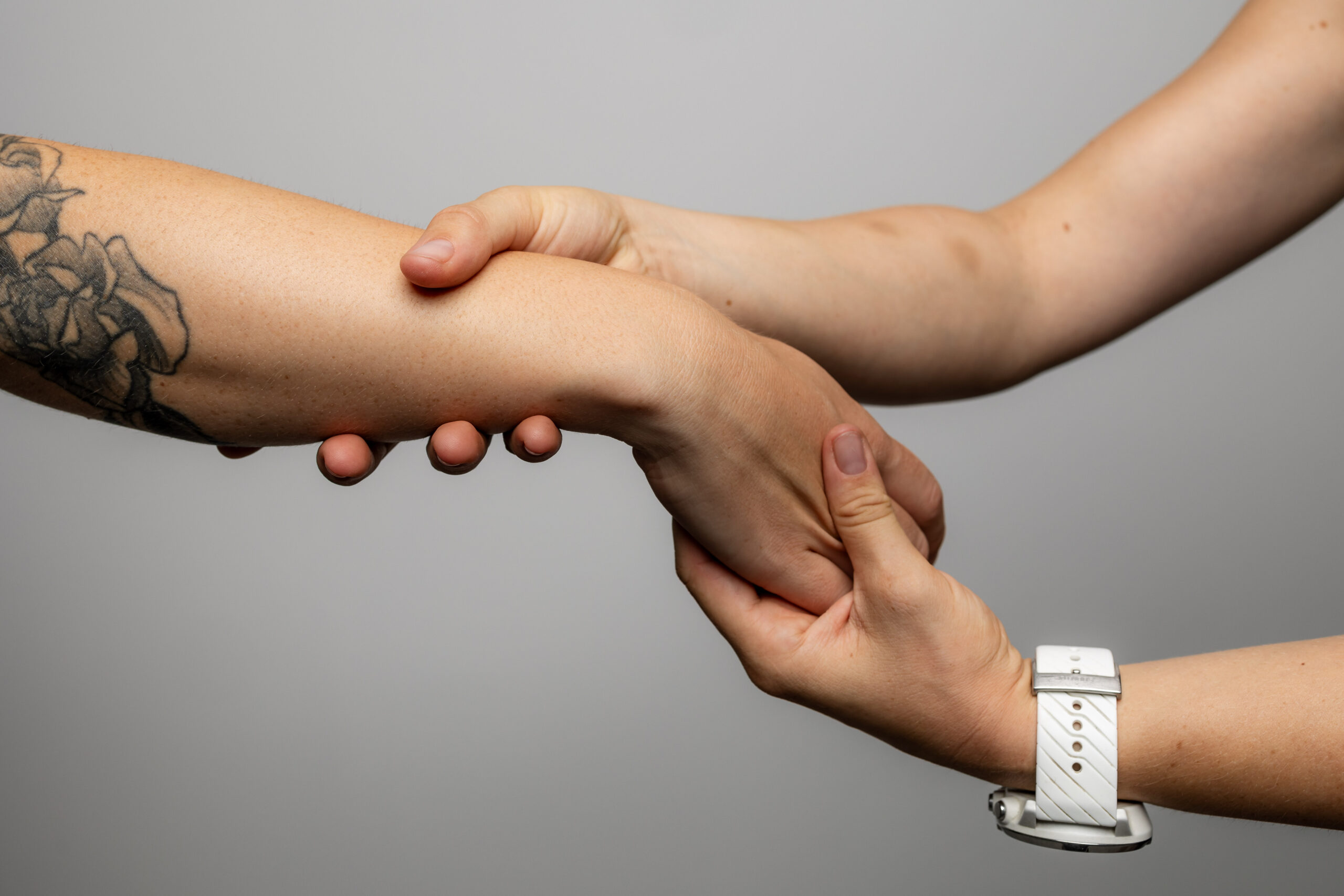 Sindrom karpalnega kanala